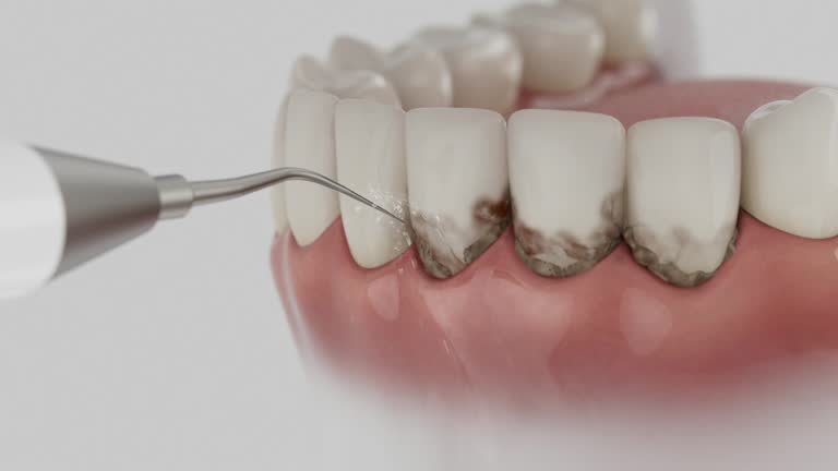 Trusted Emergency Dentist service in Ferrysburg, MI - Dentist Open Now
